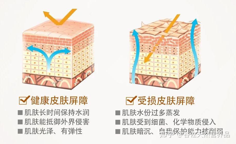 敏感肌如何修复受损发红的皮肤屏障？ - 知乎