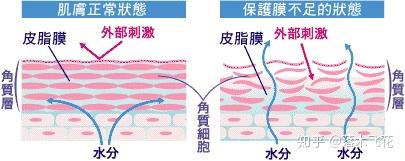 敏感肌日常护肤需要注意什么 知乎