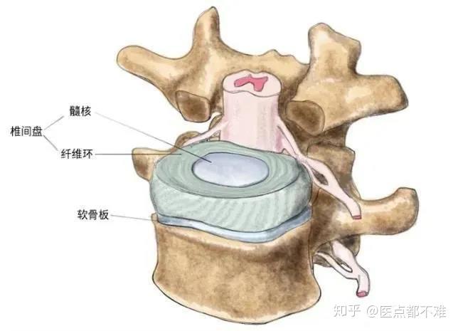 饱受腰椎间盘突出的困扰,这个疗法你知道吗 知乎