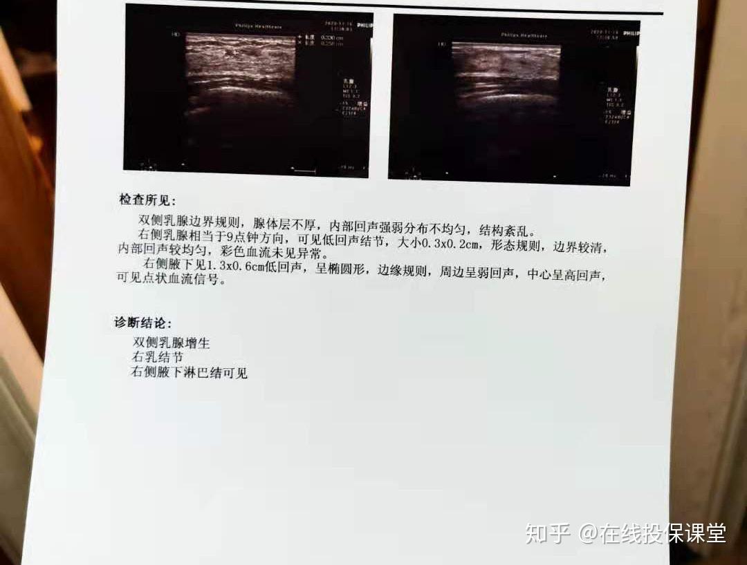 v2-d294522e58abc5cd12577018b1977c32_r.jpg