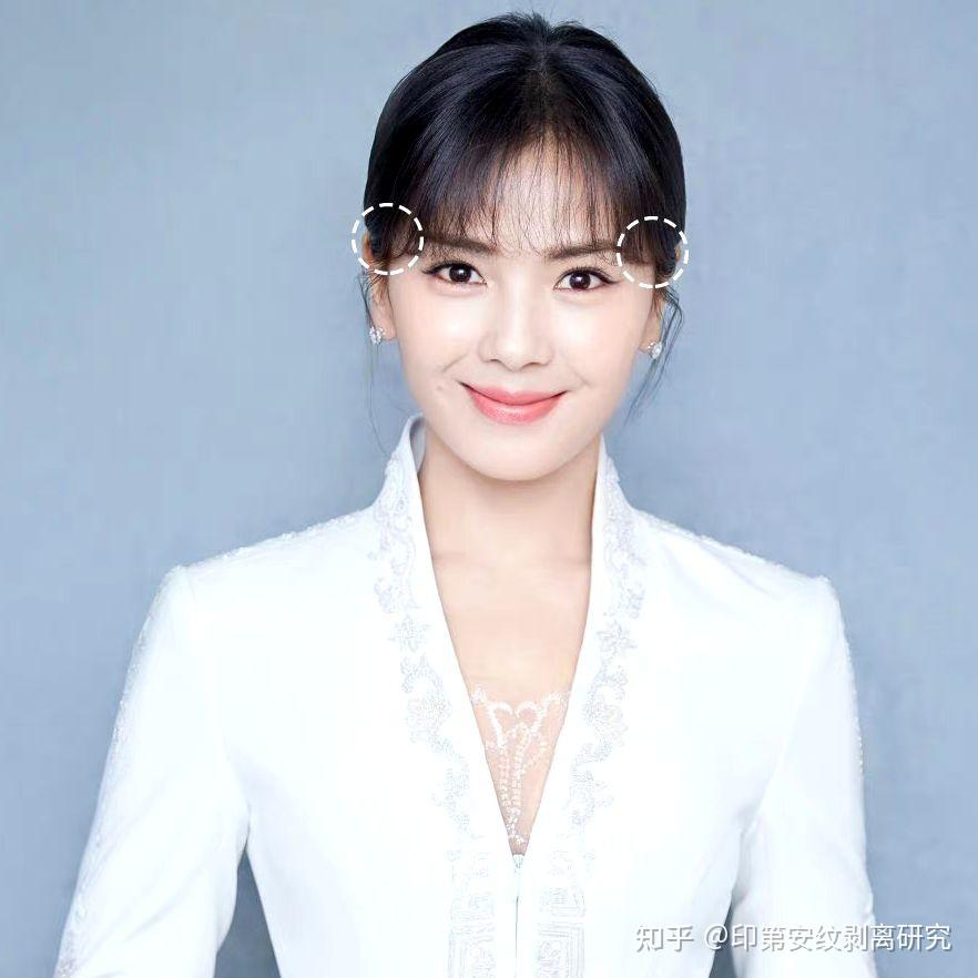 智美科普|太阳穴凹陷判断 - 知乎
