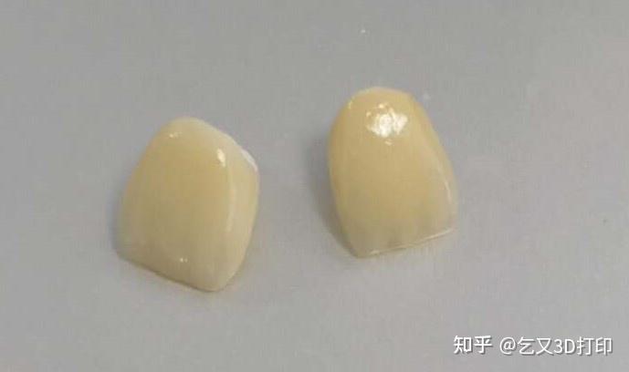 陶瓷3D打印应用——义齿&修复 - 知乎