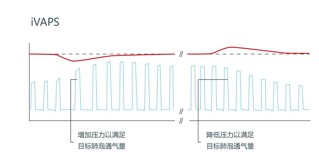 瑞思迈呼吸机IVAPS模式与传统ST模式有什么区别？ 知乎