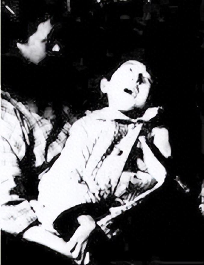 一百年没变的日本,是不是忘记了神通川的"疼疼病"