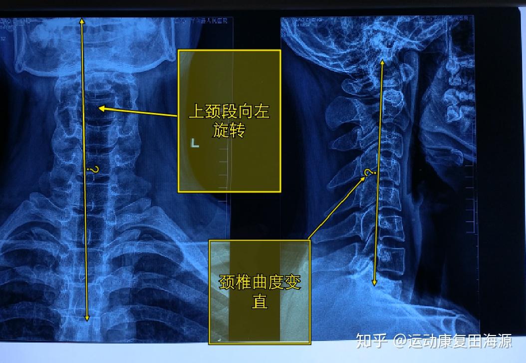 脊椎是一个整体