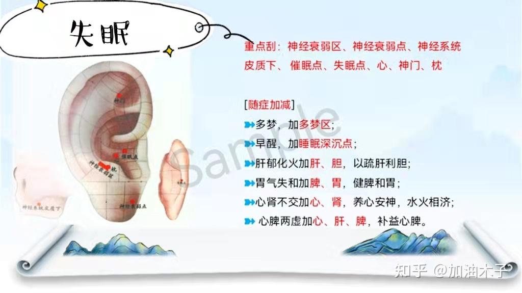 中医特色技术之耳部全息铜砭刮痧法。广州深圳中医理疗培训去华手学中医理疗怎么样?刮痧手法有哪些,刮痧拔罐实操手法 - 知乎