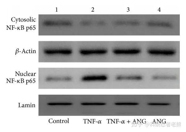 Western blot 实验大忌——稀里糊涂跑内参蛋白 - 知乎