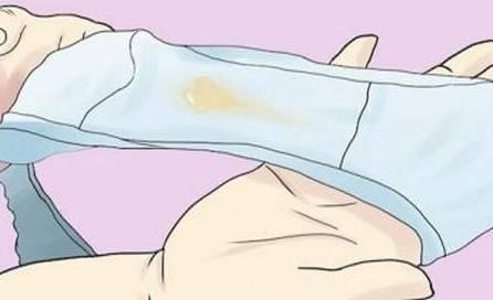 白带一定是白色不然就是阴道炎