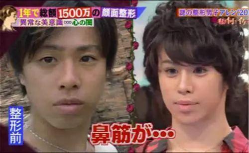 日本千万整形男所有费用竟全靠女友们支出 知乎 日本千万整形男所有费用竟全靠女友们支出 知乎