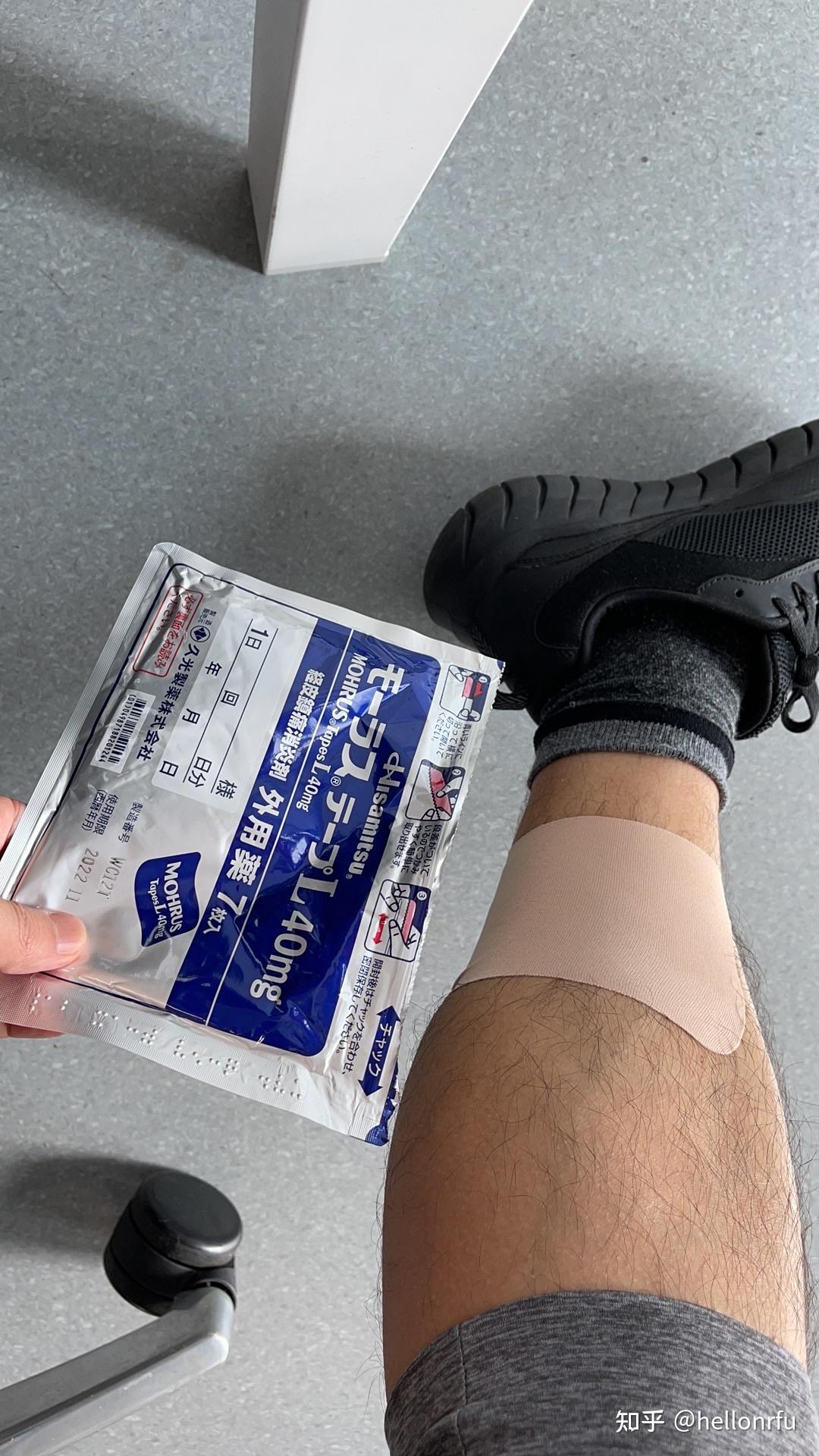 小腿贴膏药皮肤过敏的真实案例