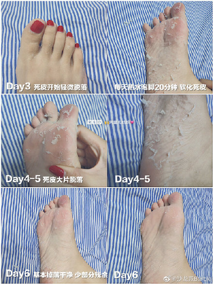 日本超变态换皮足膜 奶奶脚30分钟变少女足 瞬间去脚气 让双脚变得白白嫩嫩的miimeow足膜 知乎 日本超变态换皮足膜 奶奶脚30分钟变少女足 瞬间去脚气 让双脚变得白白嫩嫩的miimeow足膜 知乎