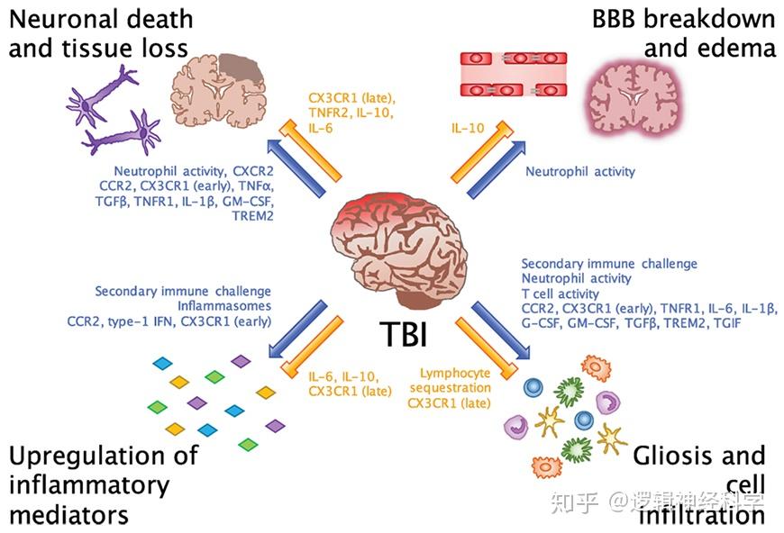 How To Treat A Traumatic Brain Injury