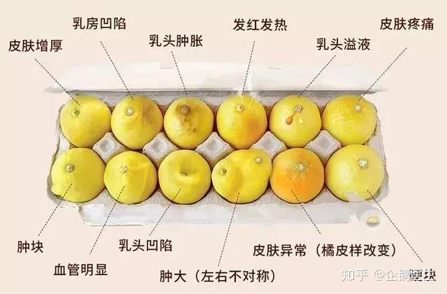 产妇喂奶怎么就得乳腺癌了呢孕期查出乳腺癌该怎么没办