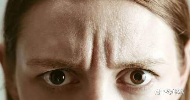 抬头纹就是额部皱纹,多为横纹,竖纹较为少见,抬头纹的产生离不开面部