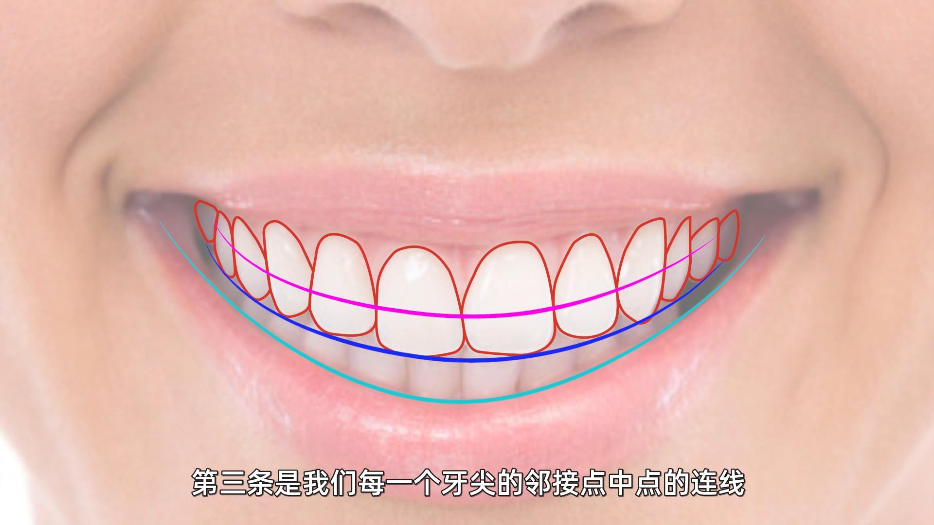 郑州牙齿矫正|中重度牙周炎 面部偏斜 矫正案例 - 知乎