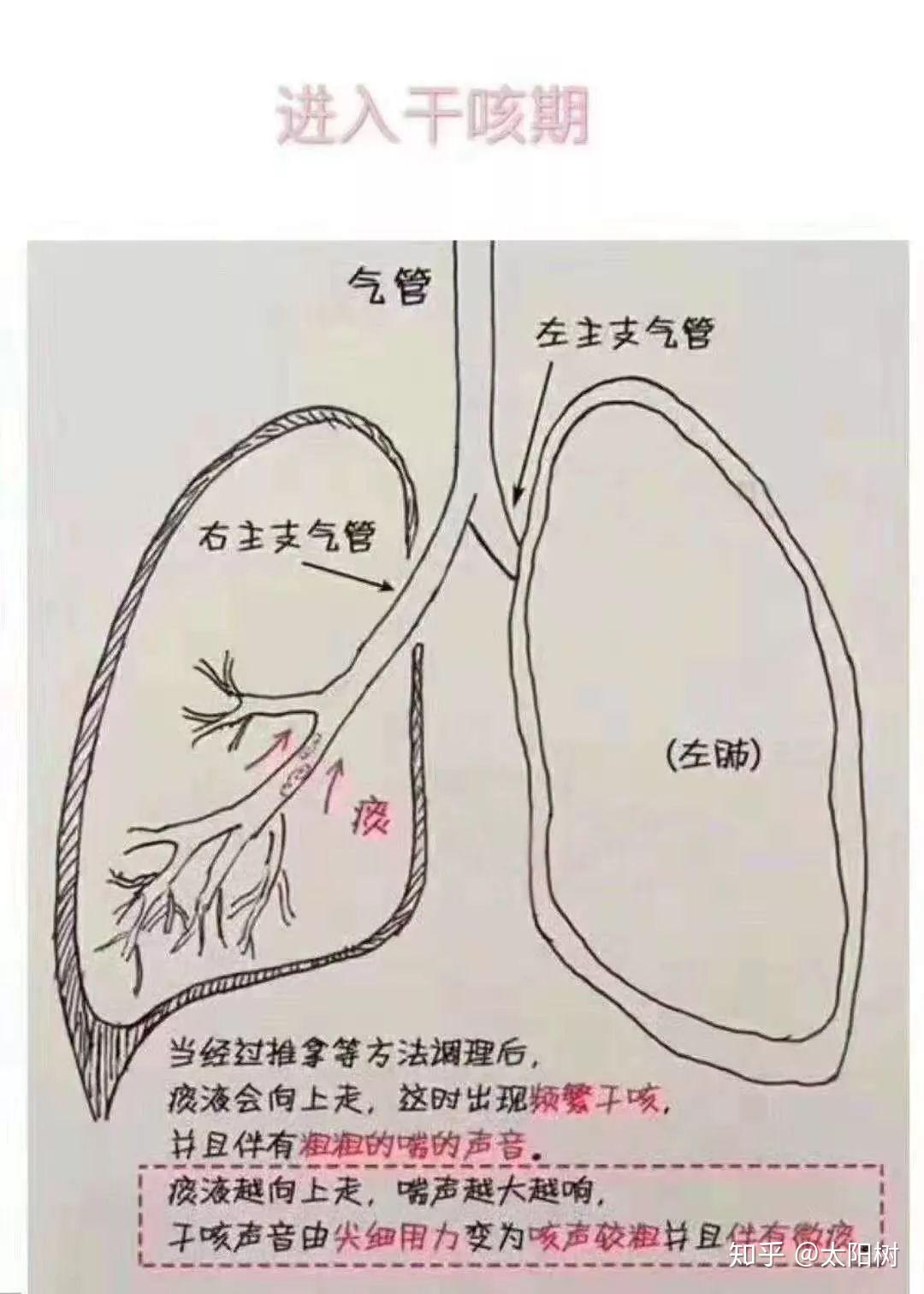 有效咳嗽示意图图片