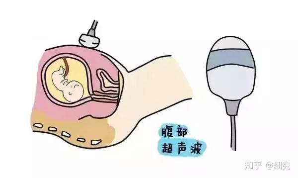 一篇搞定孕期的B超攻略!! - 知乎