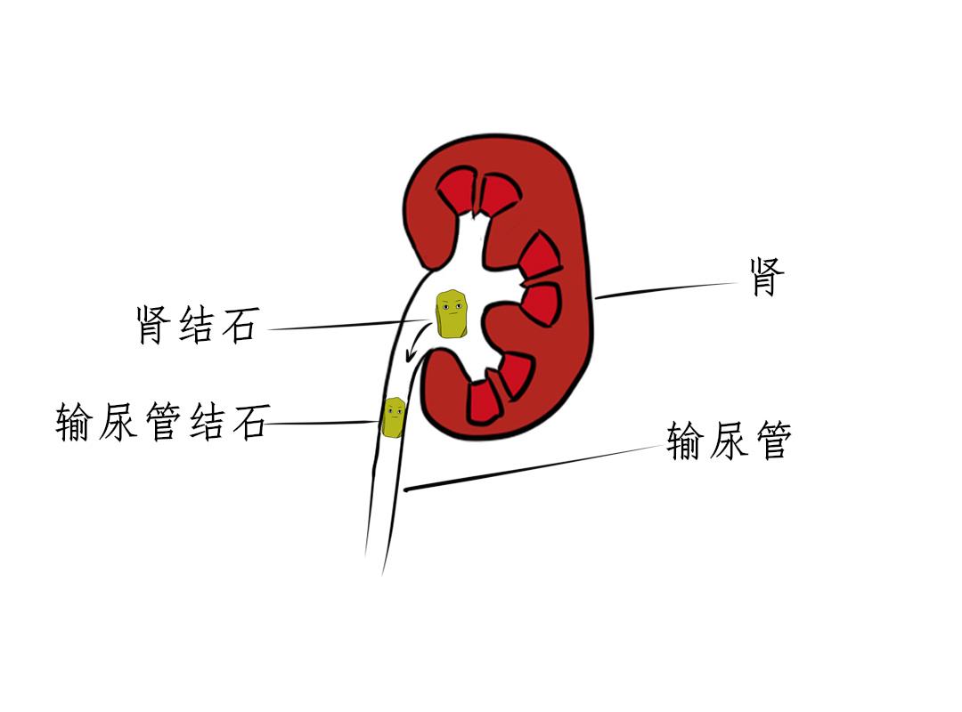 病例292 输尿管射流征-特种医学-医学