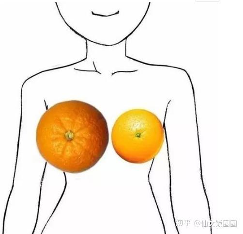 在医学上来 乳房的不对称