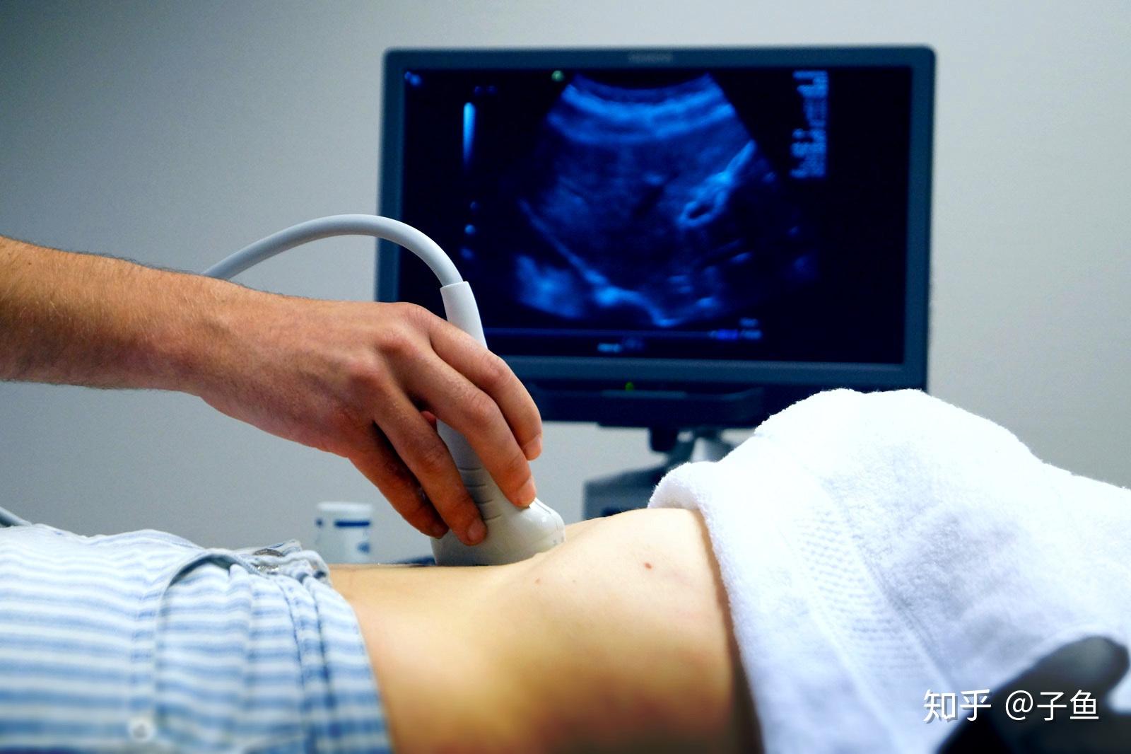怀孕婴儿的超声波扫描。_3840X2160_高清视频素材下载(编号:7887238)_实拍视频_光厂(VJ师网) www.vjshi.com