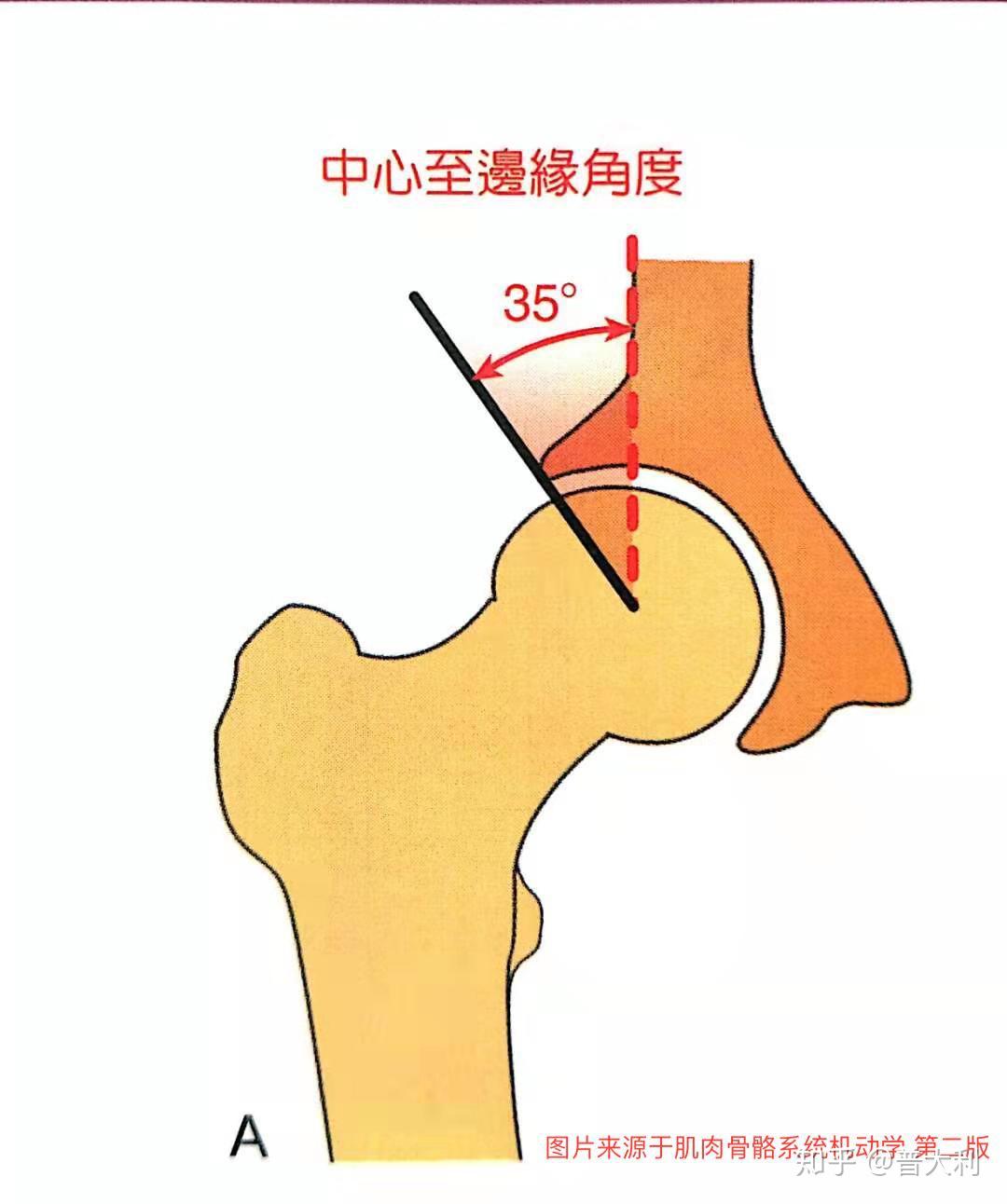 4,髖臼前傾角髖臼在水平面上相對於骨盆向前突出的程度,可以由電腦