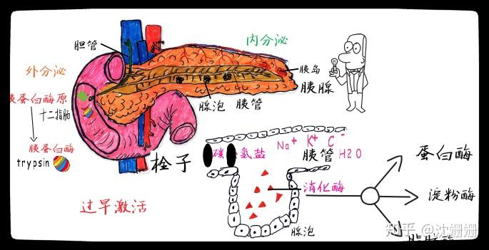 医学手绘:轻松记忆急性胰腺炎