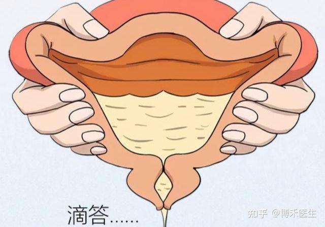 女性的尿道口的结构是怎样的?