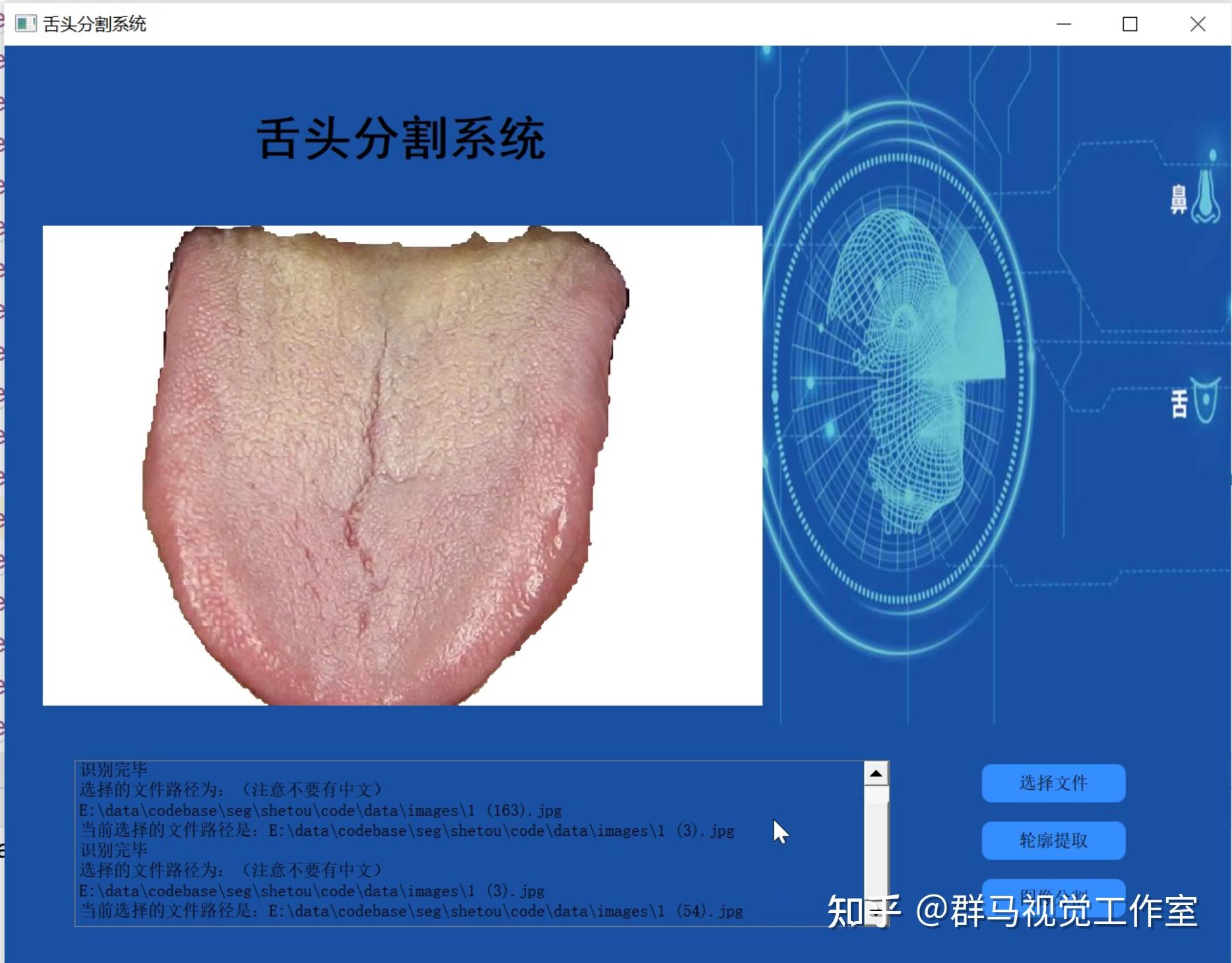 改进Unet的舌头分割系统(源码&教程) - 知乎