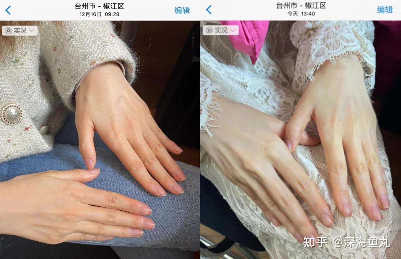 女生如何短時間內讓自己逆襲變白,變漂亮(健康白那種)? - 知乎