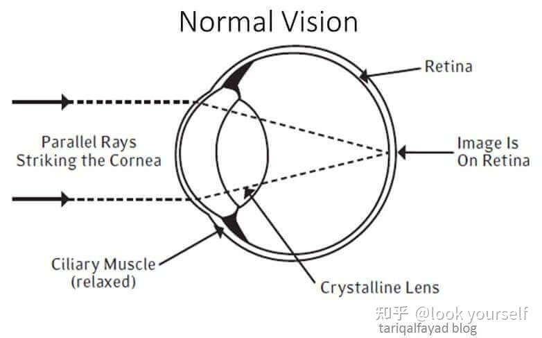 视力障碍的隐性表现
