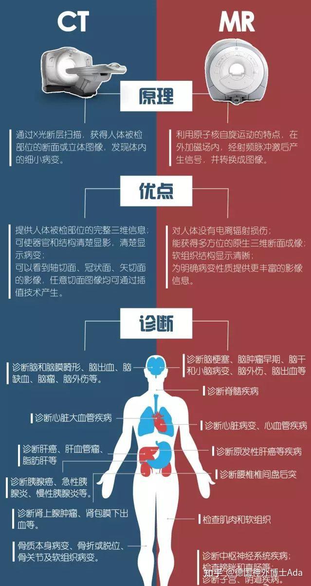 PET/CT、PET/MRI和X光、B超、CT、MRI有什么区别? - 知乎