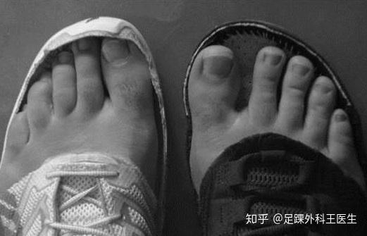 细说跑鞋的构造与功能 - 知乎