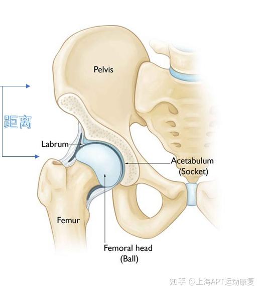 大胯骨与大腿骨图图片