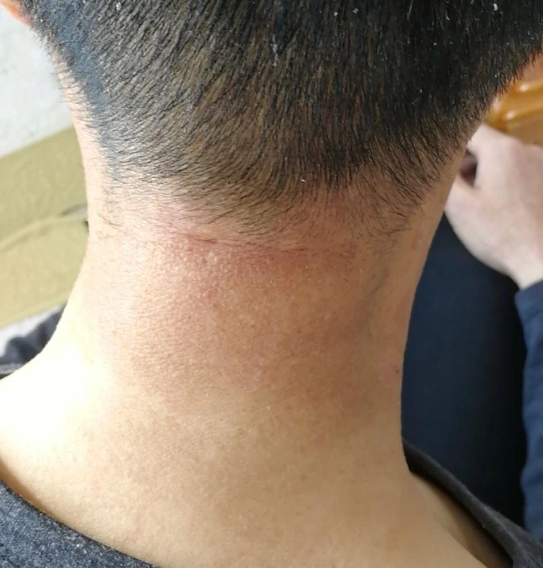 西芹汁体验案例小学霸疗愈增强眼睛视力大叔疗愈紫外线过敏