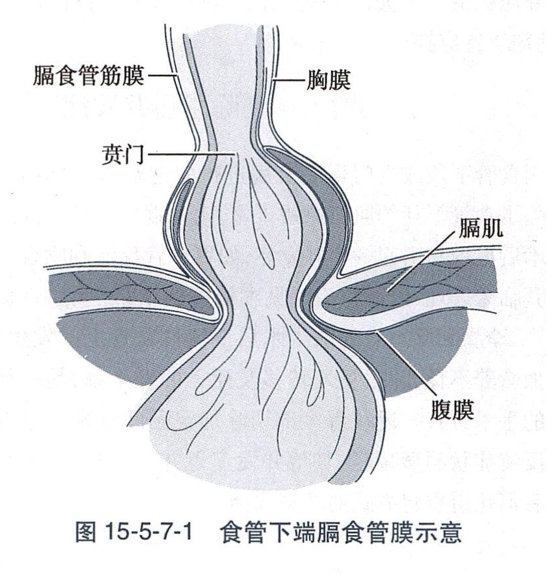 膈肌 食管裂孔图片