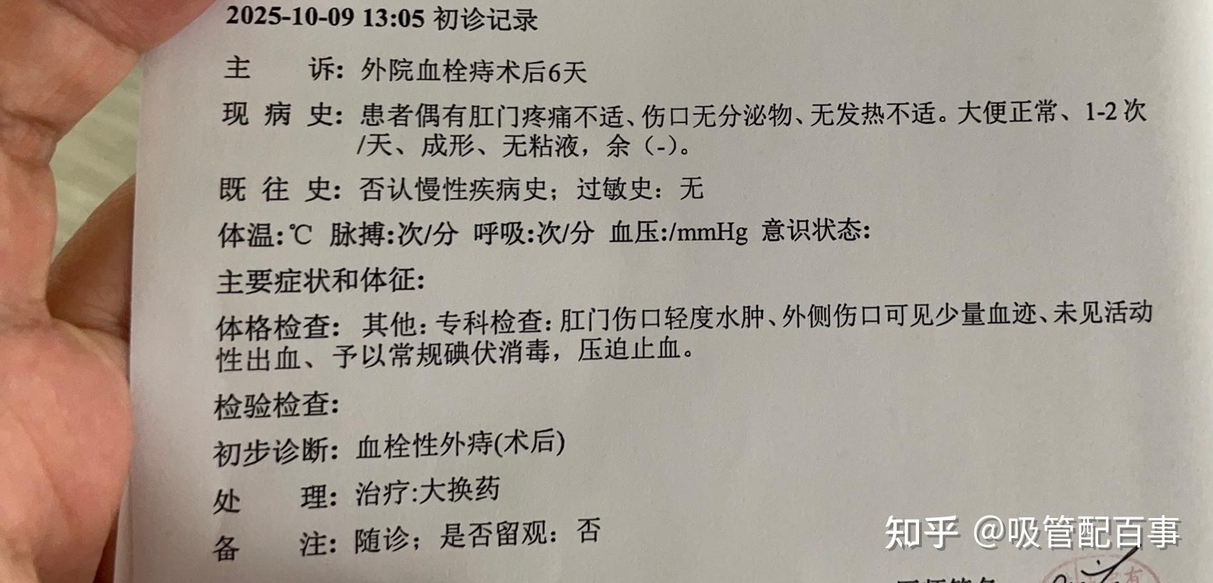 记录血栓痔,术前术后状况 - 知乎