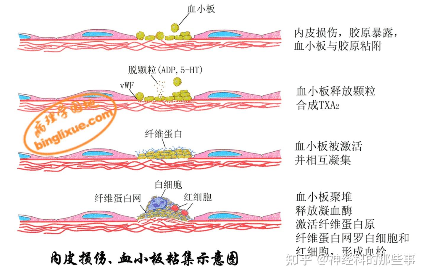 血栓形成的病理过程 - 知乎