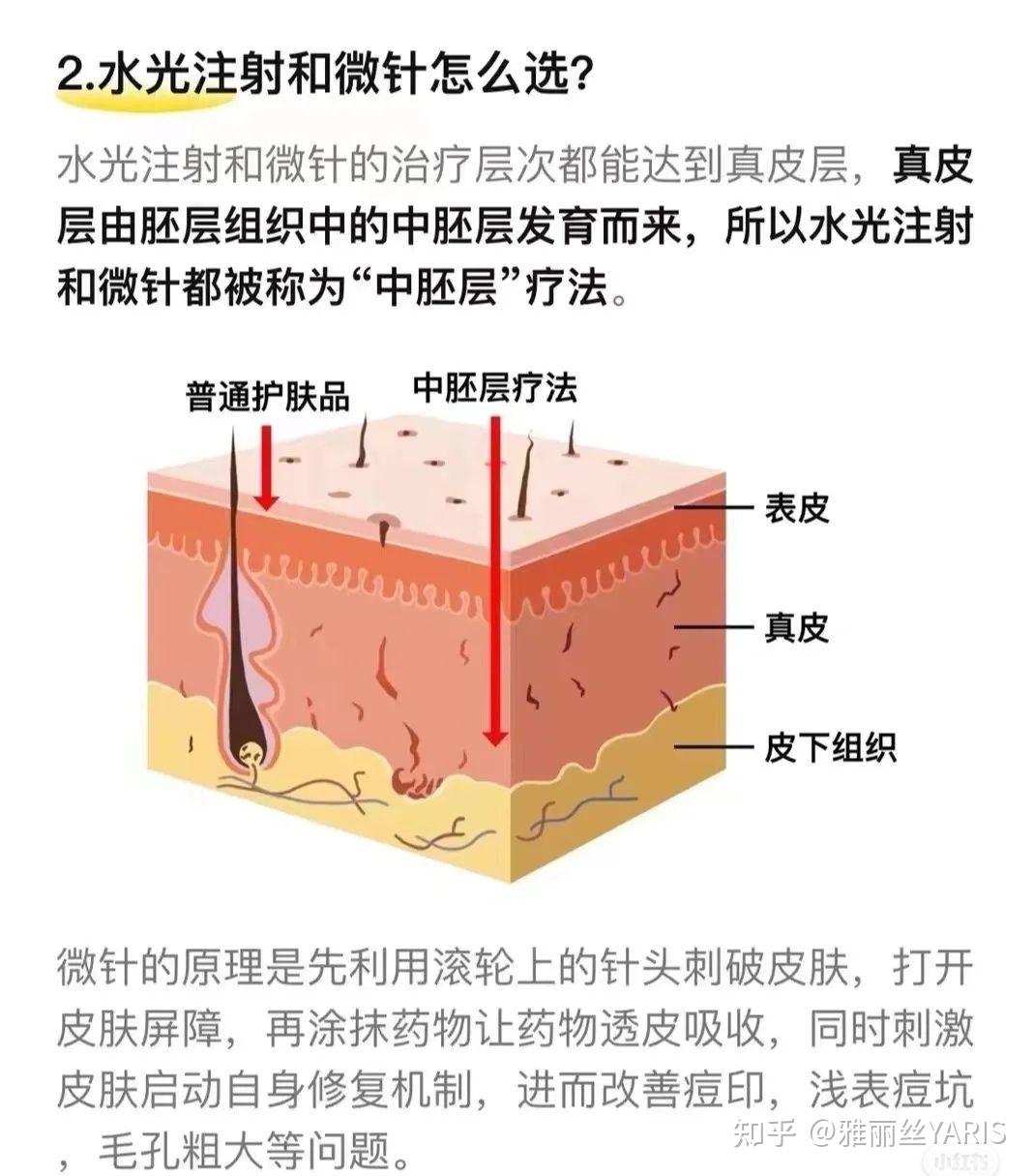 上海注射注射水光多少钱一针_上海美莱整形医院