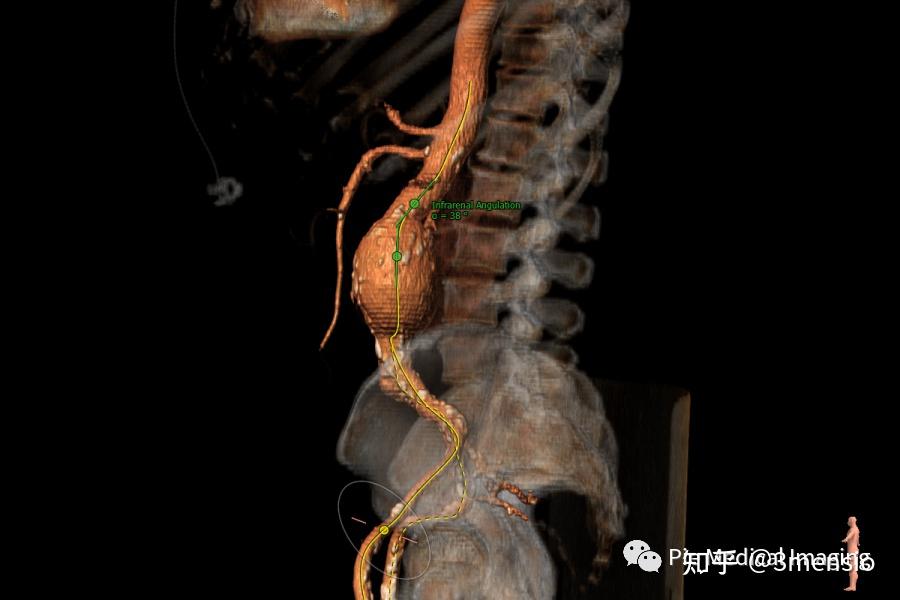 3mensio-vascular