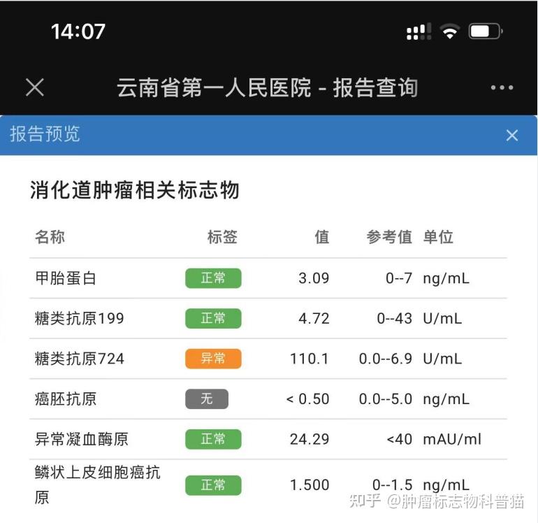 肝癌筛查新指标:异常凝血酶原(pivka-ii)