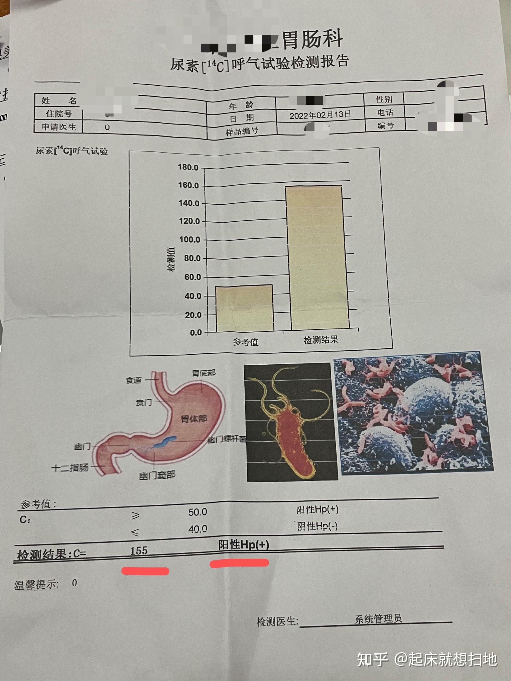 检测是否感染幽门螺旋杆菌