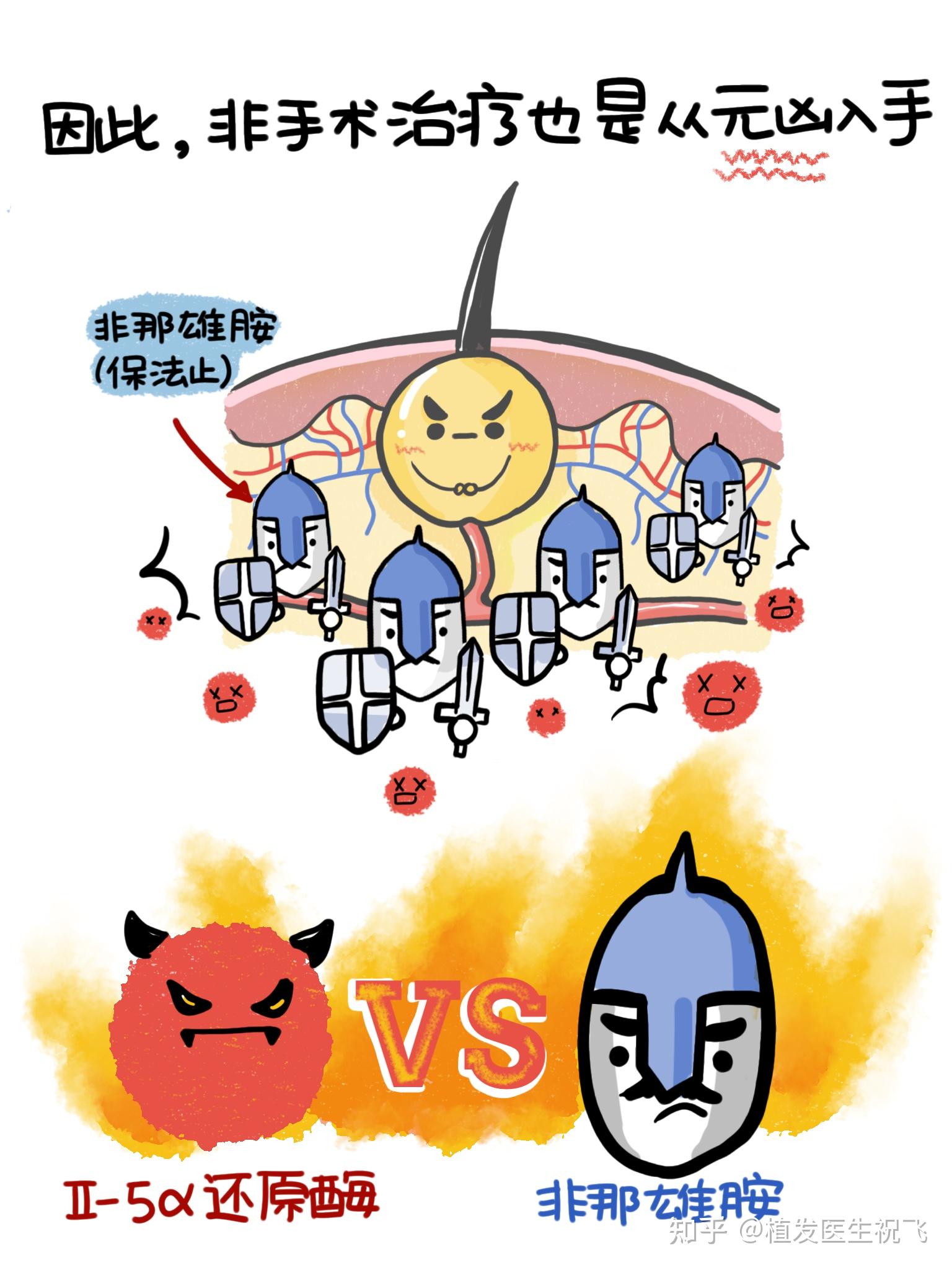 雄激素性脱发非手术治疗