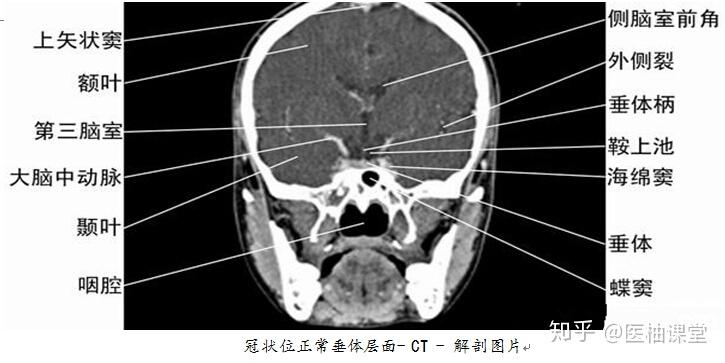 人体全身CT图谱，详细介绍... - 知乎