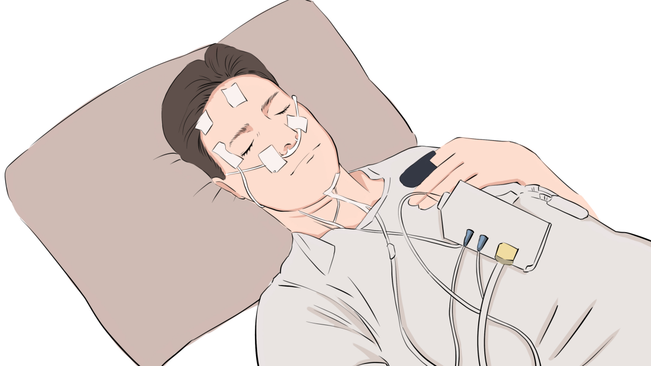 如何判断是生理性打鼾还是病理性打鼾? - 知乎