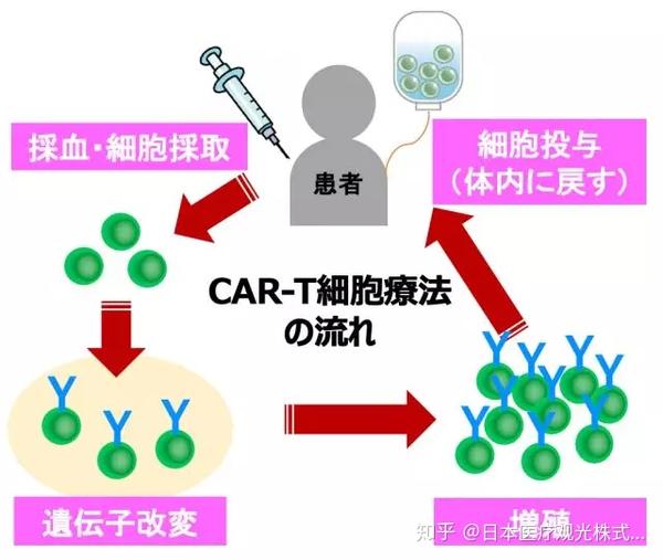 日本國內首個基因改造免疫療法cart細胞療法被批准治療白血病