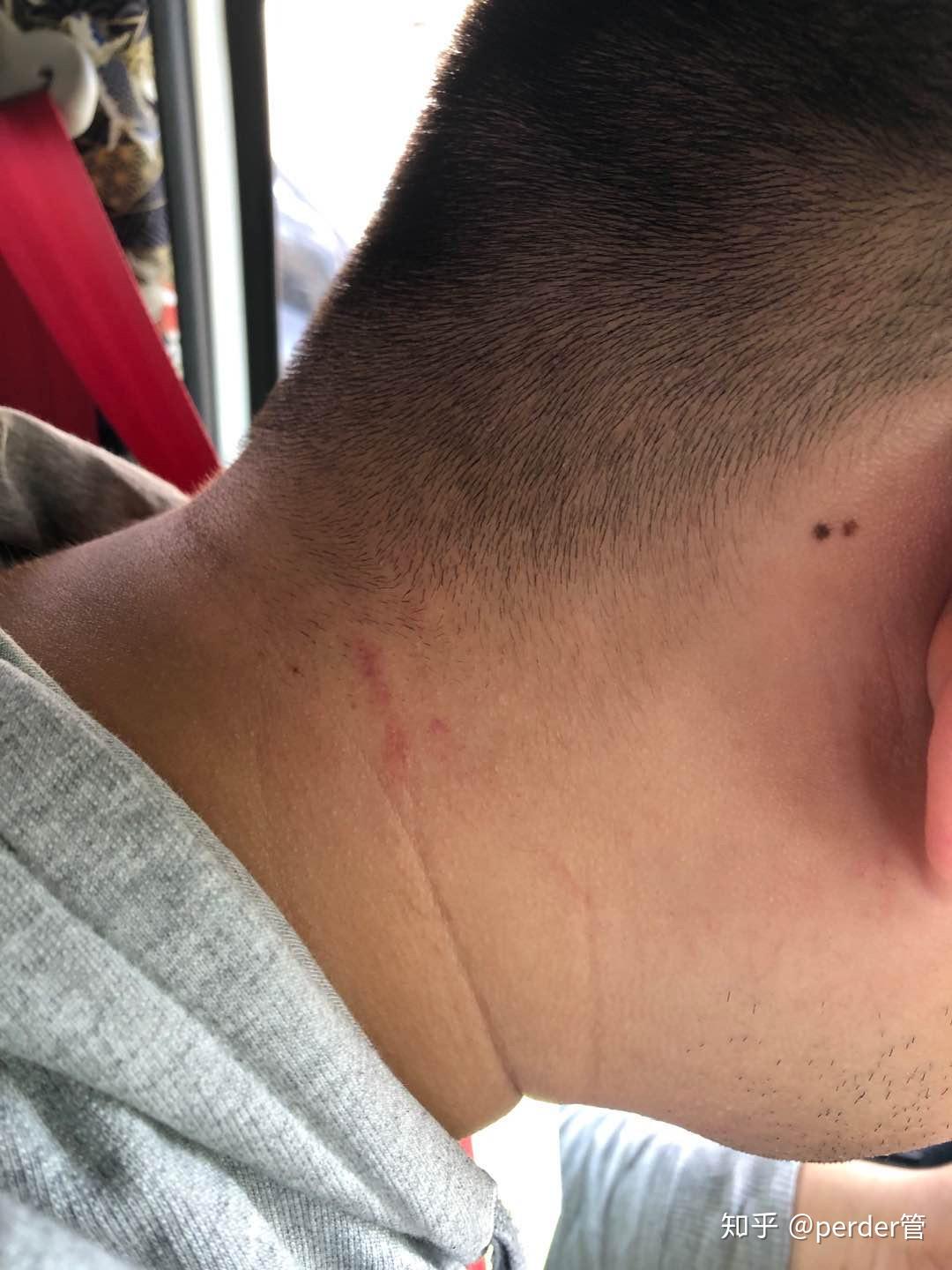 默认最新陈留白今天刹车位置出现一个比你这个还大得蜈蚣爬到我的脚