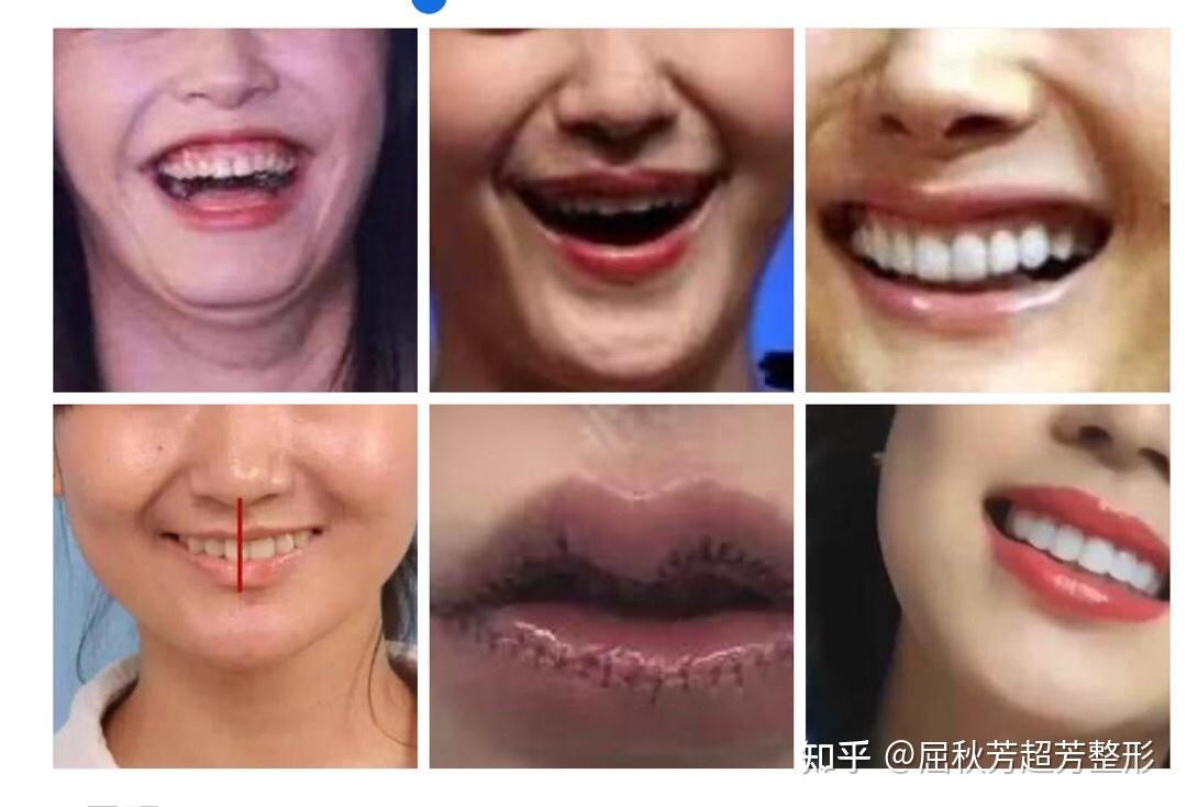 你笑起来真好看1