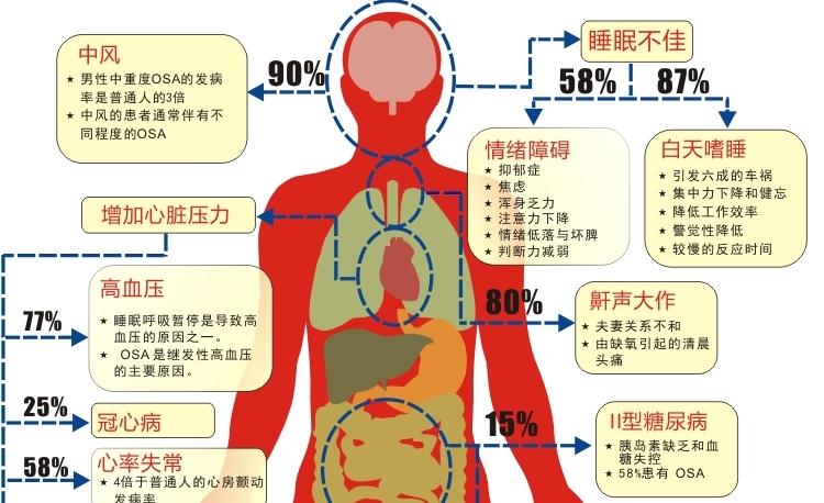v2-d98b1364f41d5a2556d4068102260792_1440w.jpg?source=172ae18b
