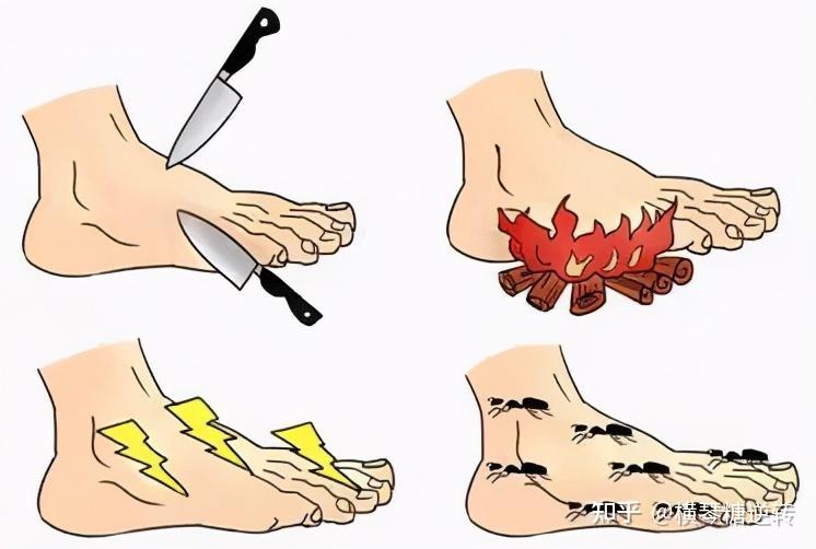 比如你走了几百米,你可能会觉得脚很疼,休息一下就能缓 解.