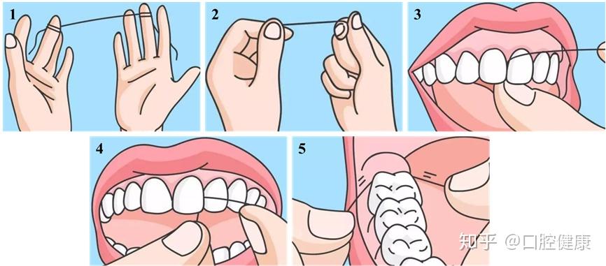 建议采用美国牙医学会(ada)推荐的牙线使用方法,更安全有效哦~带状